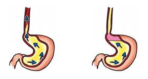 Gastrotuss baby sirup mechanismus účinku