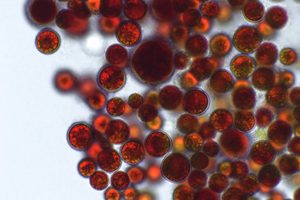 řasy Haematococcus pluvialis (Červenozrnko dešťové) pod mikroskopem